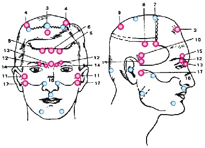spoustu akupresurních bodů najdeme i na hlavě 
